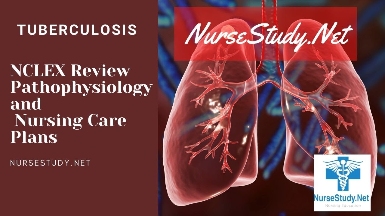 'Video thumbnail for Tuberculosis NCLEX Pathophysiology Care Plan for Nursing Students'