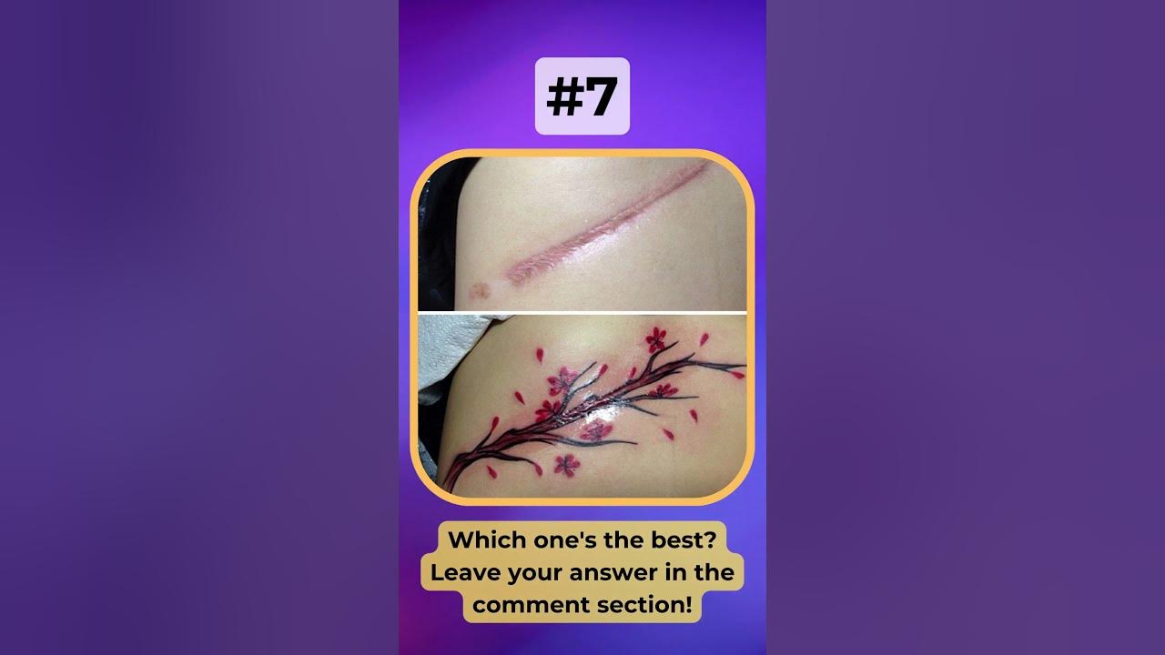 Video thumbnail for Top 10 Creative Scar Cover Up Tattoo Art: You Can Only Choose One | #Shorts