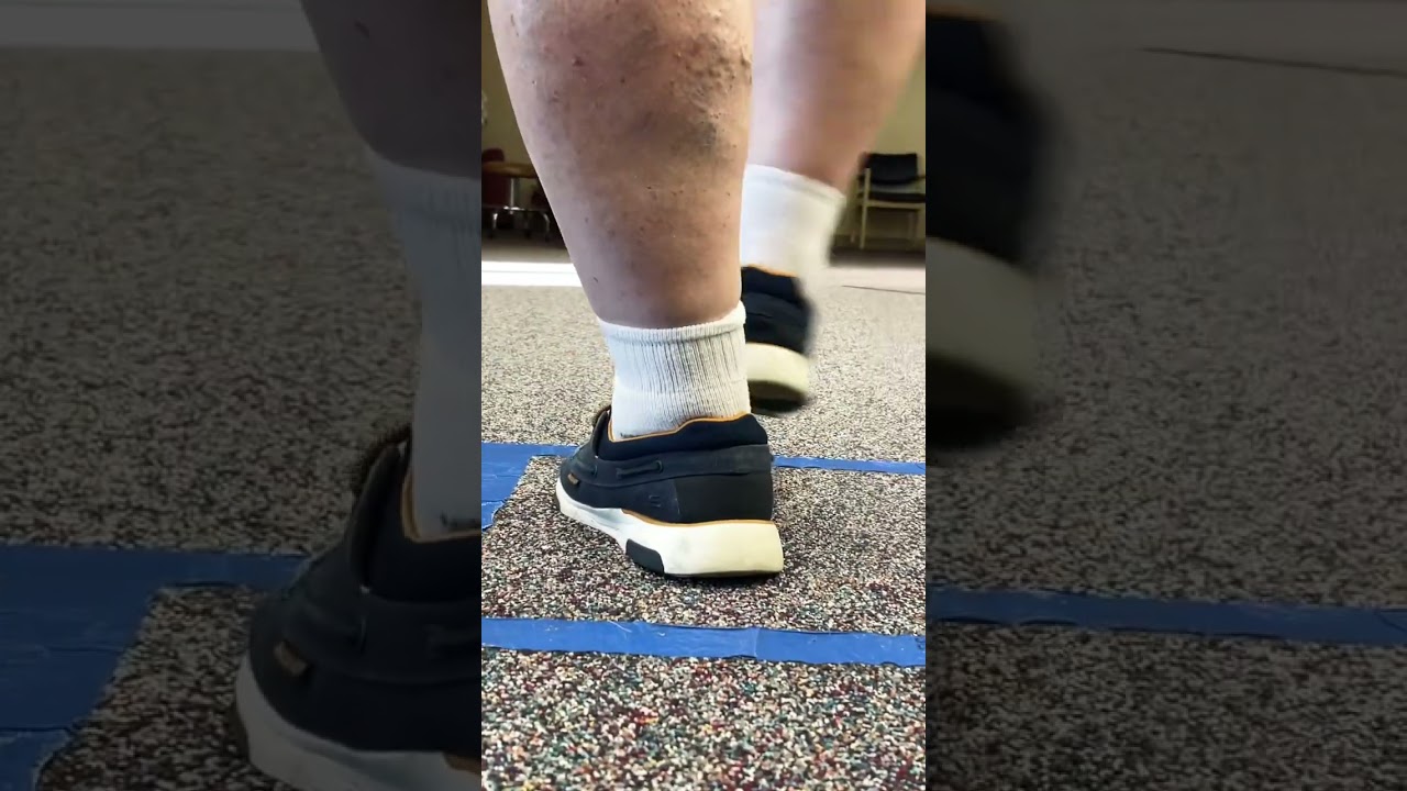 Video thumbnail for New Knee Needs New Shoes