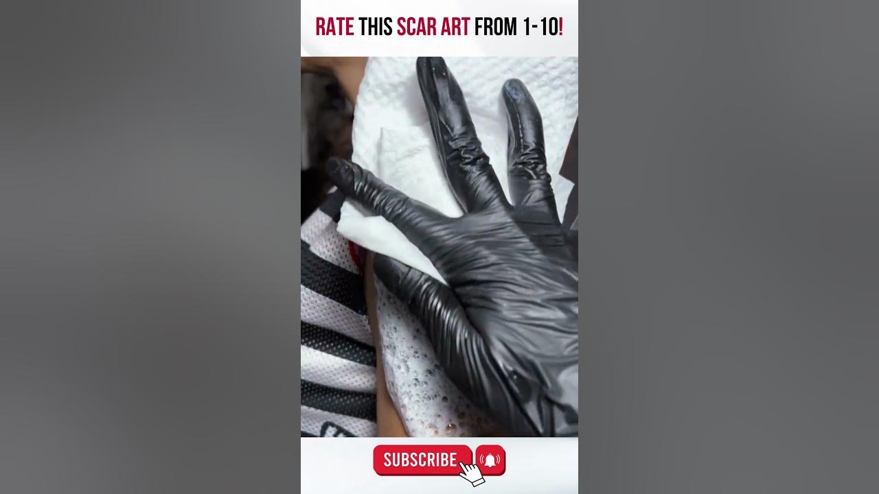 Video thumbnail for Burn Victim Gets Transformation with New Tattoo! #Shorts #BeforeandAfter