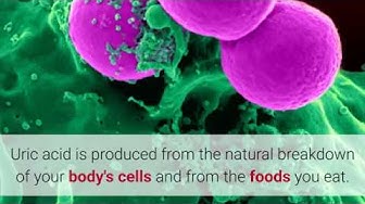 Video thumbnail for How to Lower Uric Acid Levels Quickly and Naturally!!!