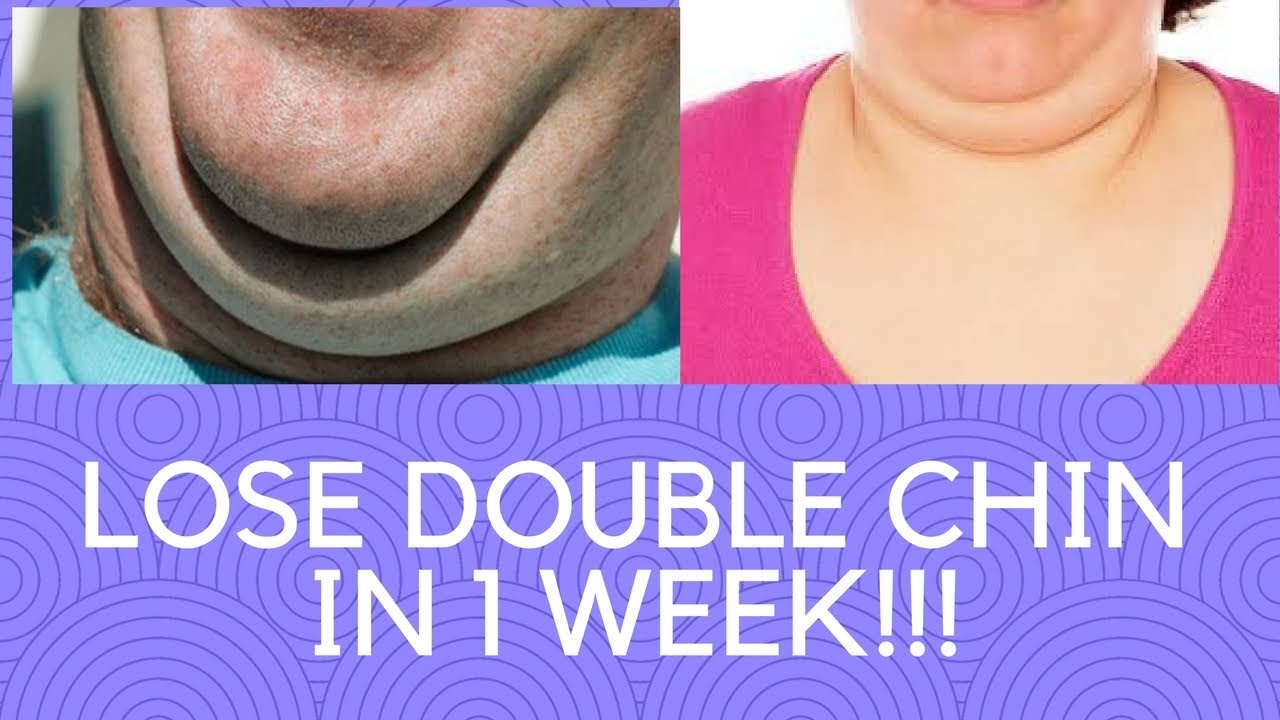 Video thumbnail for HOW TO GET RID OF A DOUBLE CHIN: LOSE YOUR DOUBLE CHIN AND TONE JAWLINE AT HOME FAST!!!