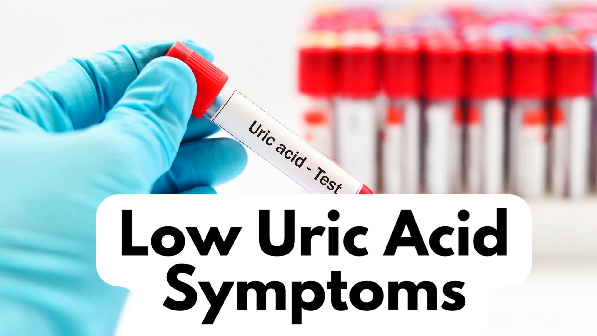 'Video thumbnail for Low Uric Acid Symptoms- video'