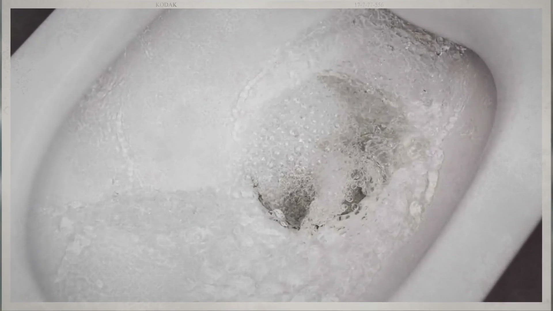 Video thumbnail for Toilet Water Splashed on Me (Stop and Do This ASAP!)