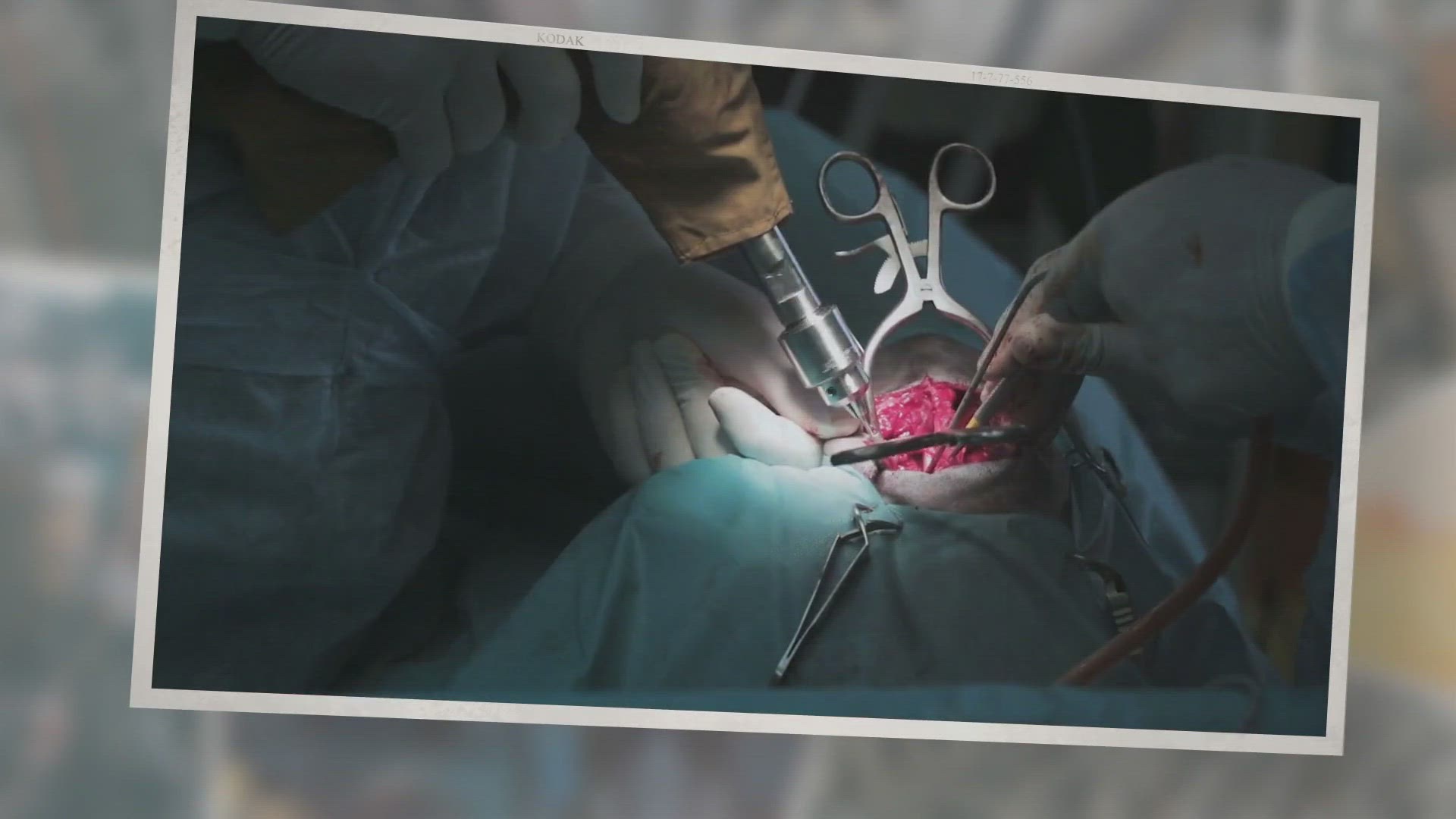 'Video thumbnail for How Soon Can I Walk My Dog After Neutering?'