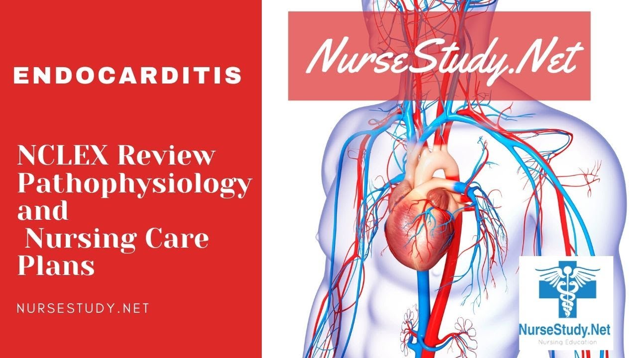 'Video thumbnail for Endocarditis Nursing NCLEX Pathophysiology Care Plan for Nursing Students'