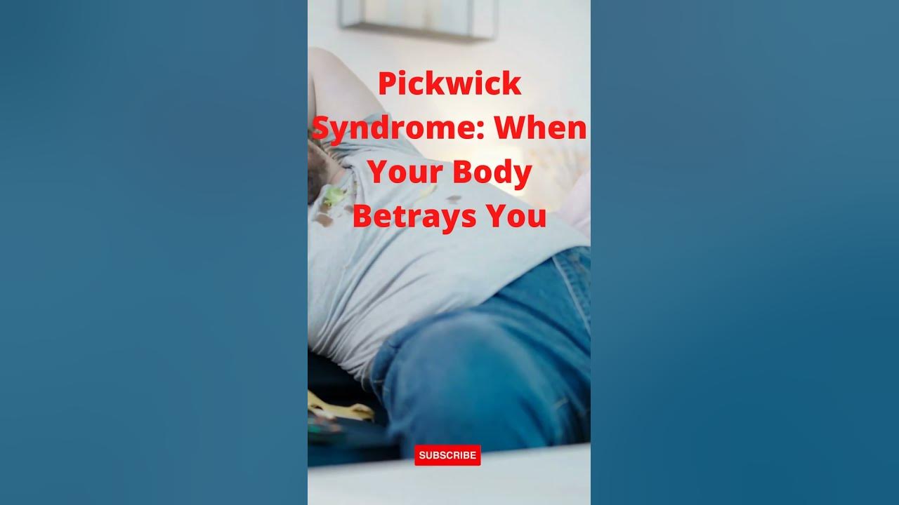 'Video thumbnail for Pickwick Syndrome When Your Body Betrays You #shorts #orobesityhypoventilationsyndrome'