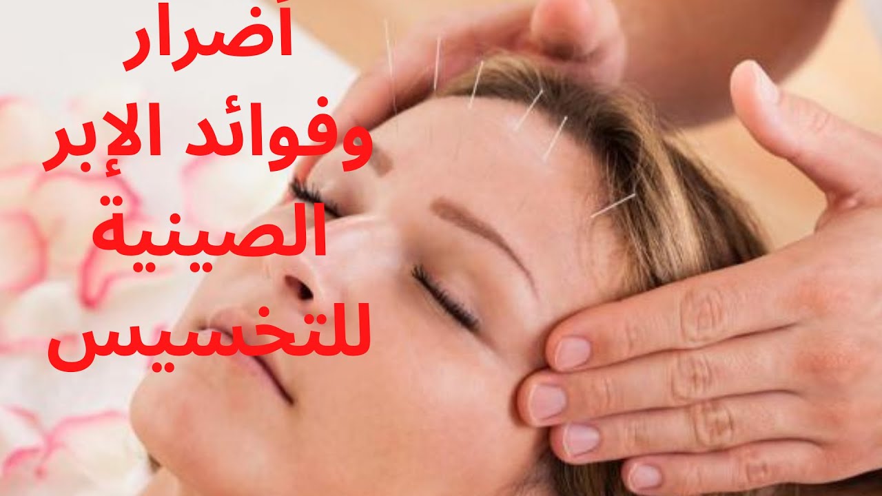 Video thumbnail for أضرار وفوائد الإبر الصينية للتخسيس