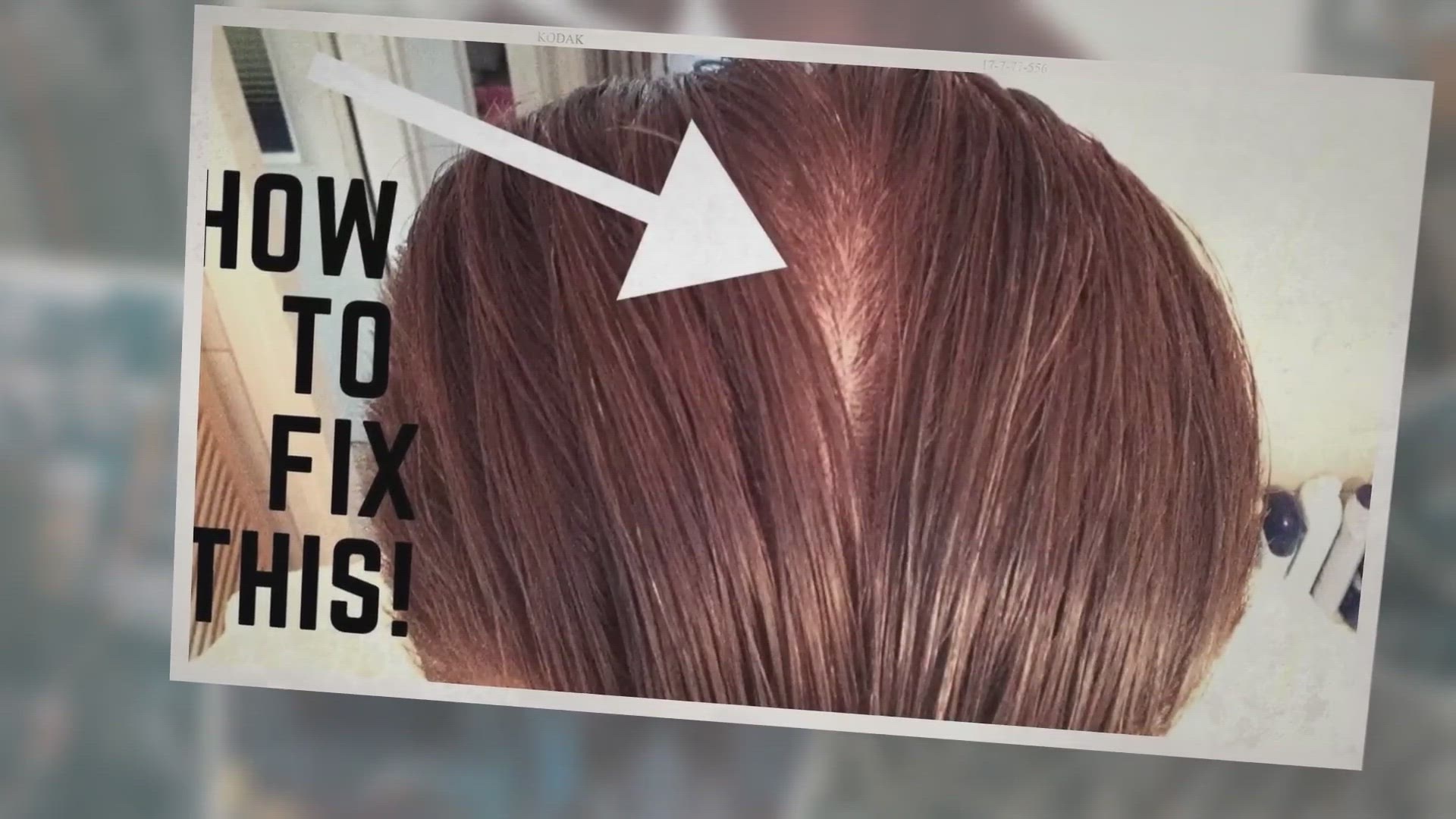 Video thumbnail for Why has my hair started parting in the back?
