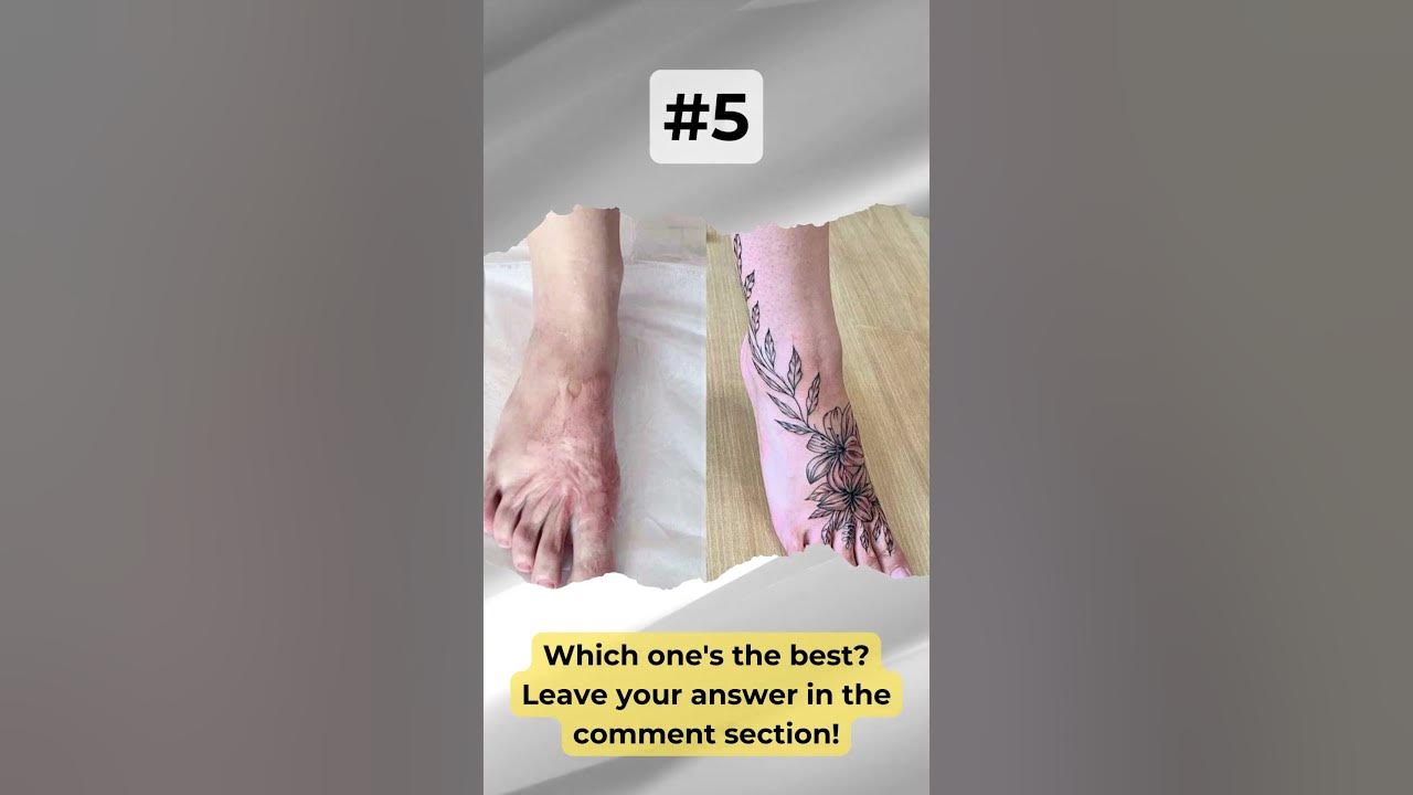 Video thumbnail for 9 Awesome Scar Cover-Up Tattoo Ideas: You Can Only Choose One! | #Shorts