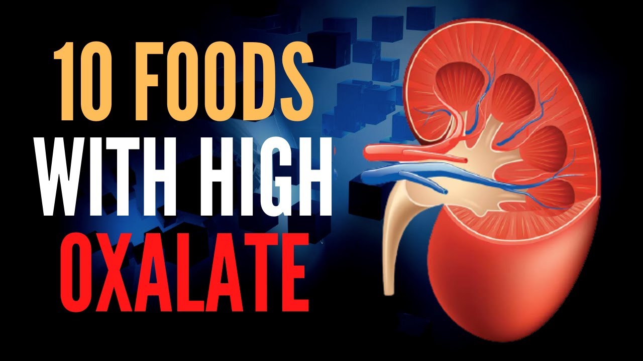 Video thumbnail for Kidney Stones | 10 Foods With High Oxalate