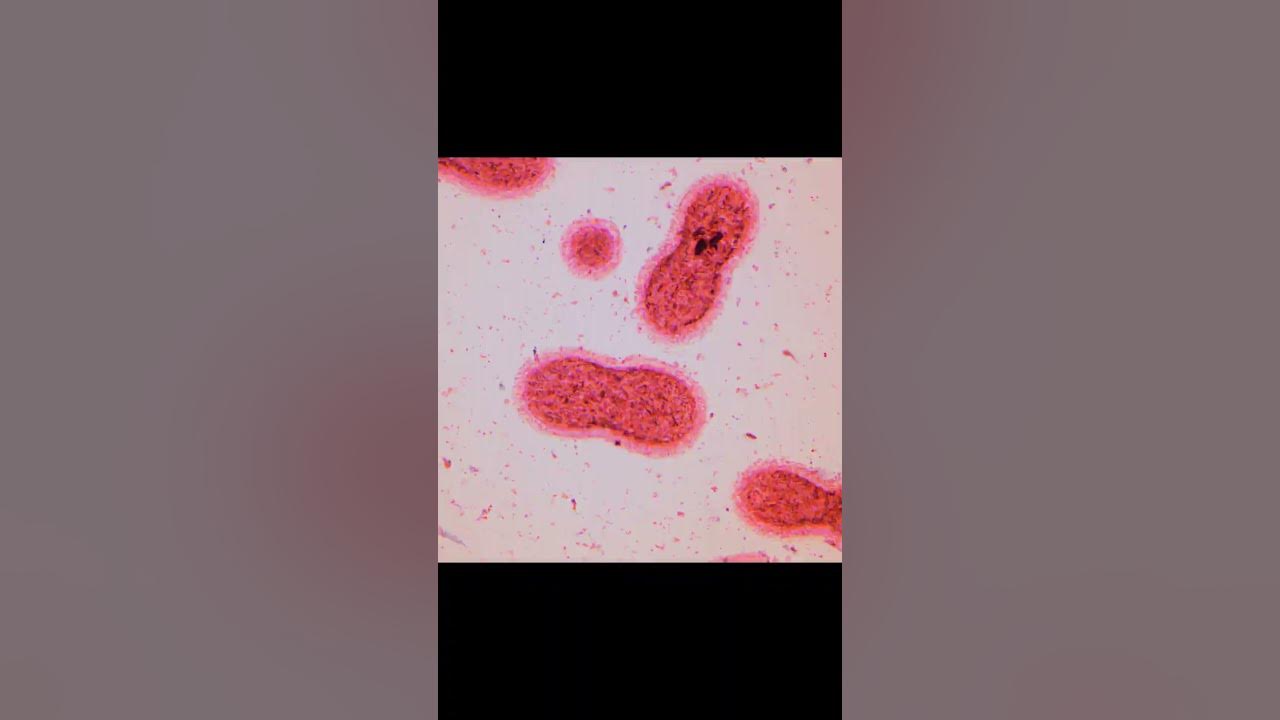 'Video thumbnail for Liberando el potencial de una bacteria que come plástico'