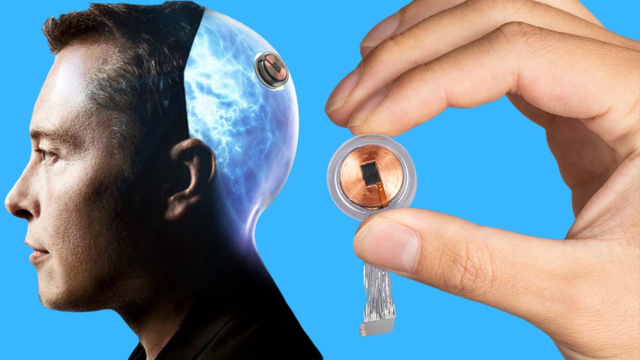Video thumbnail for Neuralink update : Elon Musk's Neuralink Inches Closer to Human Trial