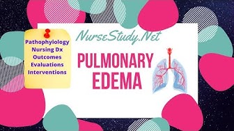 'Video thumbnail for Pulmonary Edema Pathophysiology Care Plan for Nursing Students'