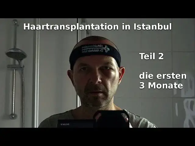 'Video thumbnail for Haartransplantation in Istanbul (2) die ersten 3 Monate'