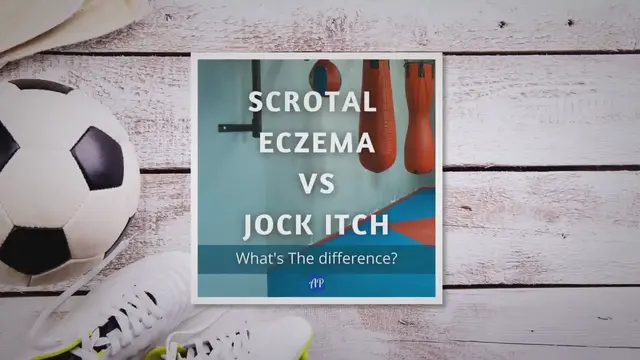 'Video thumbnail for Scrotal Eczema vs Jock Itch: What’s The Difference?'
