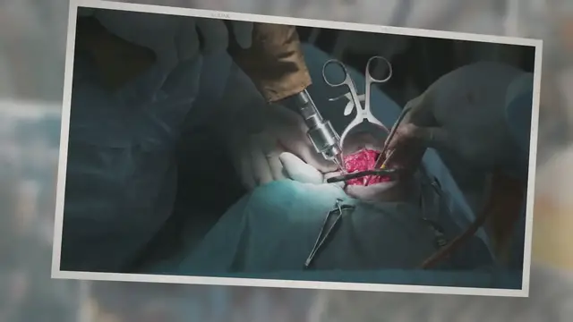'Video thumbnail for How Soon Can I Walk My Dog After Neutering?'