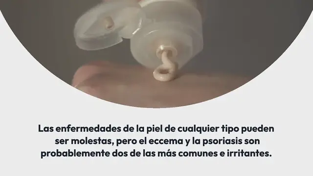 'Video thumbnail for Crema curativa natural para eccema y psoriasis hecha en casa'