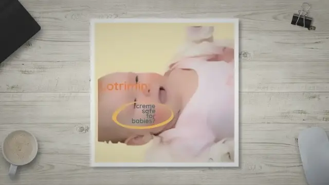 'Video thumbnail for Lotrimin cream for babies 101 Guideline'