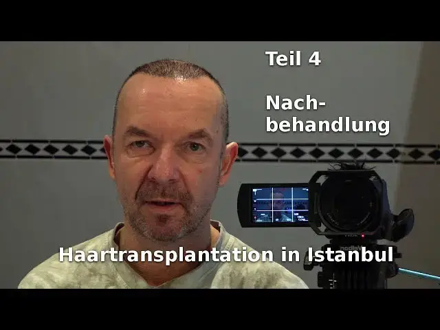 'Video thumbnail for Haartransplantation in Istanbul (4) Nachbehandlung'