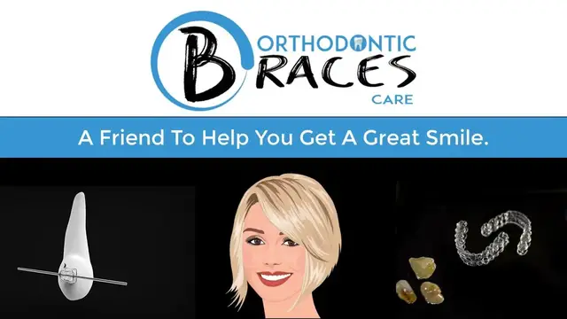 'Video thumbnail for Orthodontic Braces care - Welcome'