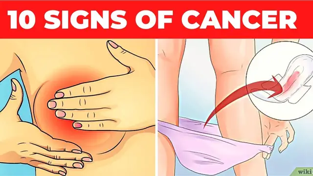 'Video thumbnail for 10 Early Signs of Cancer Mostly Ignored By Women'