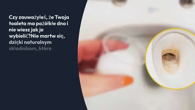 'Video thumbnail for Pożółkłe dno toalety biegnij do kuchni i natychmiast się go pozbądź: wystarczy jedna kropla'