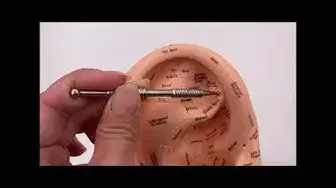 'Video thumbnail for Ear Acupuncture Point For Sympathetic Nerve'