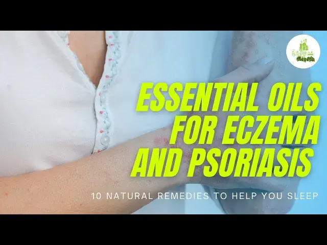 'Video thumbnail for Essential Oils for Eczema and Psoriasis - 10 Natural Remedies To Help You Sleep'