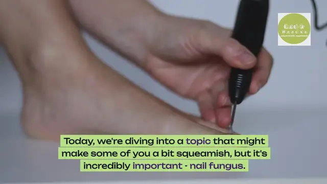 'Video thumbnail for Does vinegar cure nail fungus'