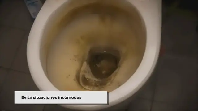 'Video thumbnail for ▷ ¿Cómo elimino las manchas fecales de los inodoros? (7 maneras fáciles)'