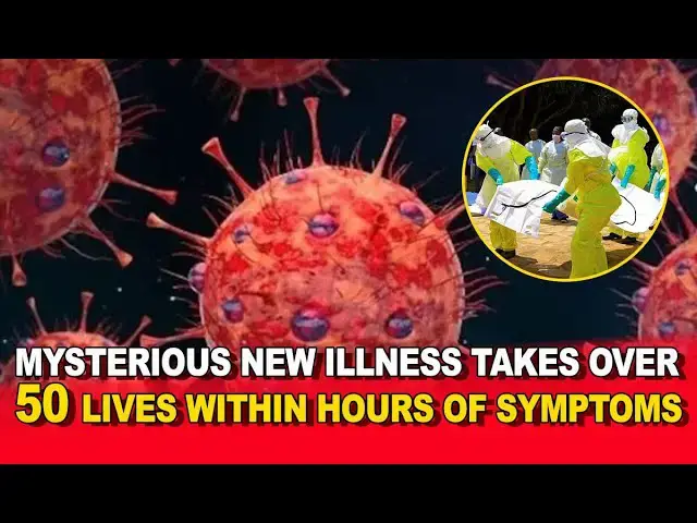 'Video thumbnail for Mysterious New Illness Takes Over 50 Lives Within Hours of Symptoms 😱 | What You Need to Know'