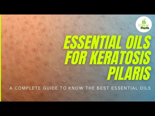 'Video thumbnail for Essential oils for Keratosis pilaris: a complete guide to know the best essential oils'