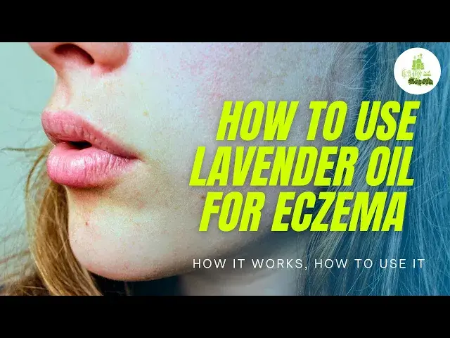 'Video thumbnail for How to Use Lavender Oil for Eczema | How It Works, How To Use It and Potential Side Effects'