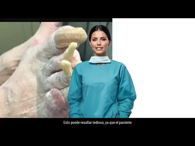 'Video thumbnail for hongos en las uñas'