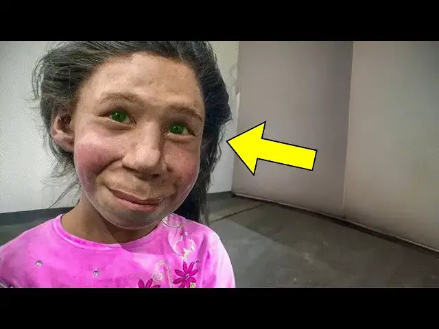 'Video thumbnail for Scientists Discover Girl Born From Two Different Species'