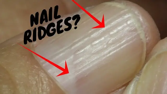 'Video thumbnail for Do You Have These Vertical Ridges On Your Nails?-Palmistry'