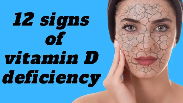 'Video thumbnail for 12 signs of vitamin D deficiency'