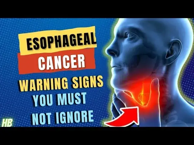'Video thumbnail for 7 Causes  Warning Signs Of Esophageal Cancer You Must Not Ignore'