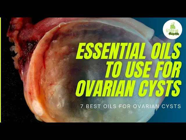 'Video thumbnail for Essential oils to use for ovarian cysts - 7 BEST Oils for Ovarian Cysts: What Really Helps!!!!'