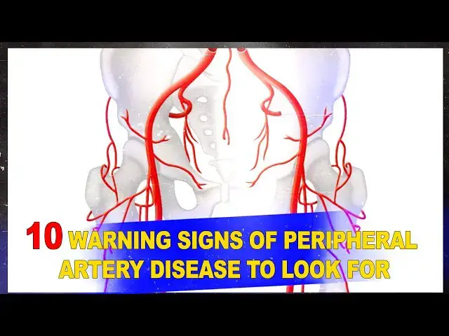 'Video thumbnail for 10 Warning Signs of Peripheral Artery Disease (PAD) 🚨 | Don’t Ignore These Symptoms!'
