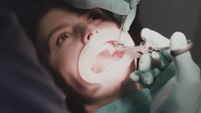 'Video thumbnail for Understanding Dental Procedures: From Simple Extractions to Complex Surgeries'