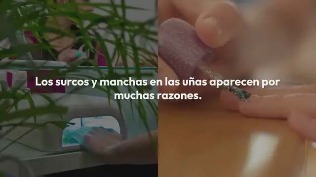 'Video thumbnail for Los surcos y manchas en las uñas pueden indicar estas cosas sobre tu salud'