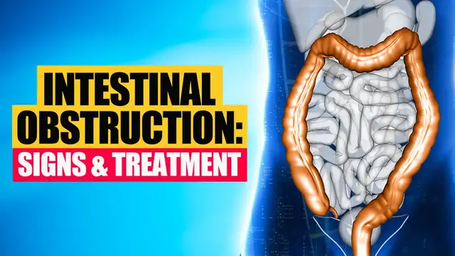 'Video thumbnail for Intestinal Obstruction: Symptoms, Causes, Diagnosis & Treatment '