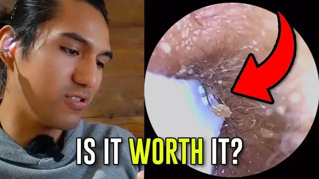 'Video thumbnail for What To Expect With This Earwax Tool Camera'