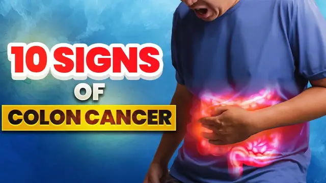'Video thumbnail for ? 10 Signs of COLON CANCER (Don't Ignore)'