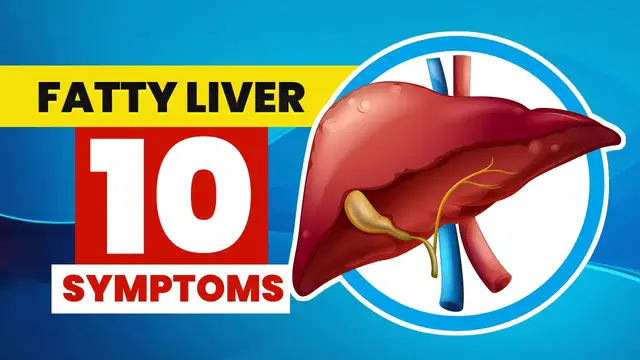 'Video thumbnail for ⚡ Top 10 Signs and Symptoms of Fatty Liver You MUST AVOID'