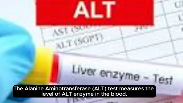'Video thumbnail for ALT Test (Alanine Aminotransferase Test)'