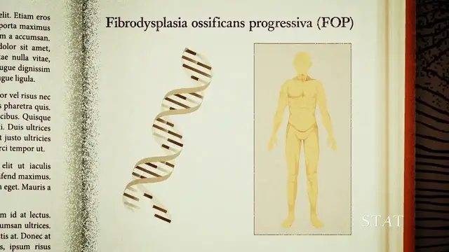 'Video thumbnail for This rare disease turns muscle into bone'