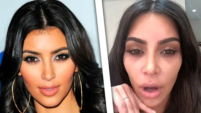 'Video thumbnail for Celebrities Without Makeup in Real Life'